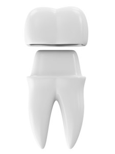 Dental Crown