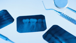 Dental x-rays